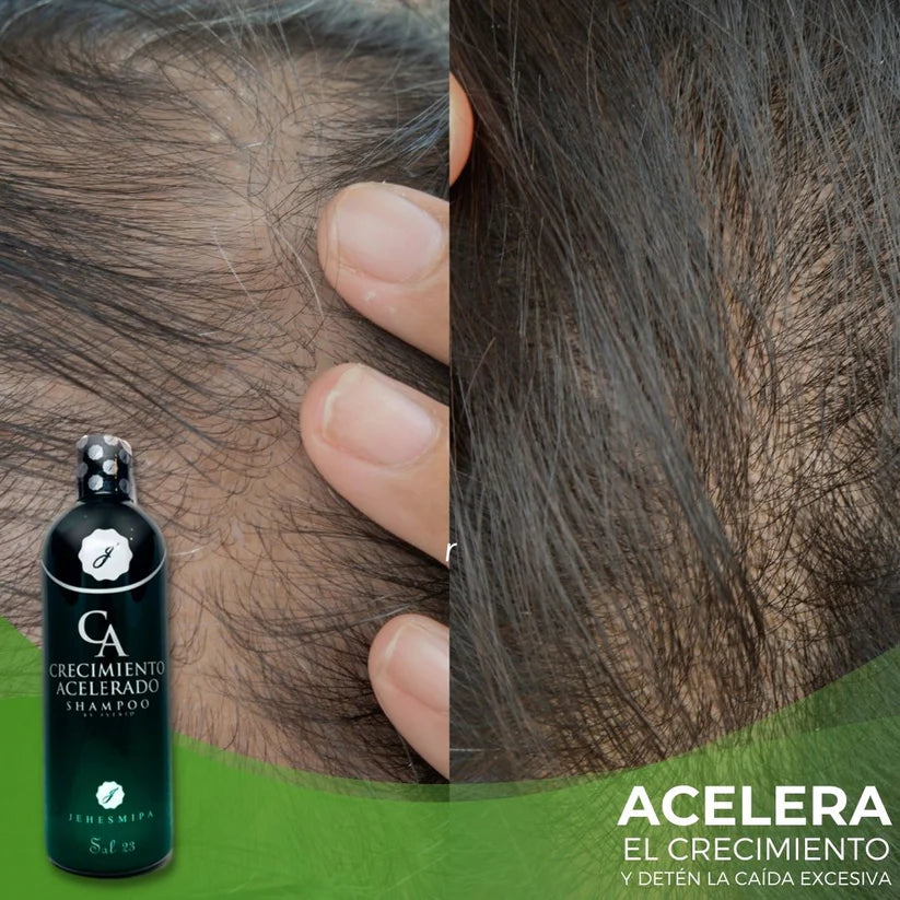 Shampoo crecimiento acelerado | Producto original ✅
